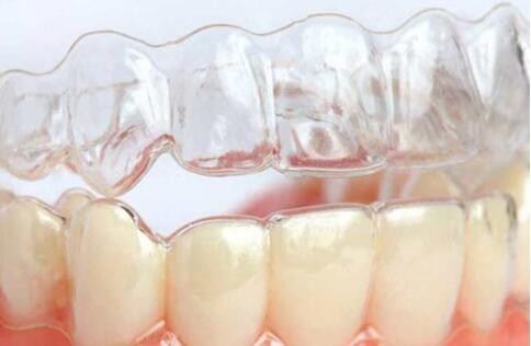 洛阳牙齿矫正：牙齿稀疏矫正一般要多少钱？
