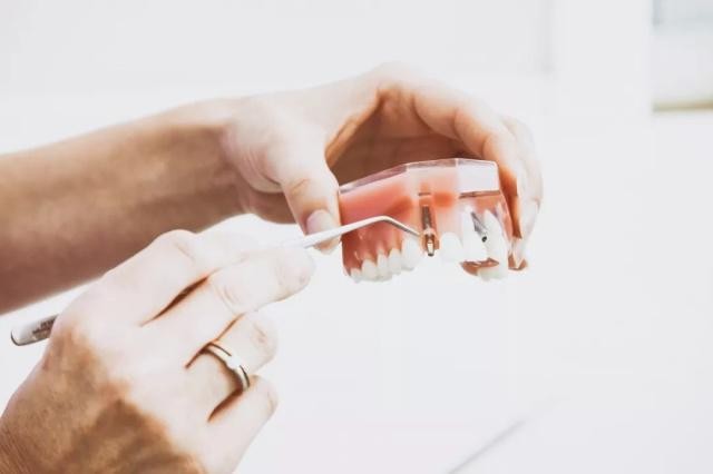 洛阳做即刻种植牙最好的牙科医院是哪家