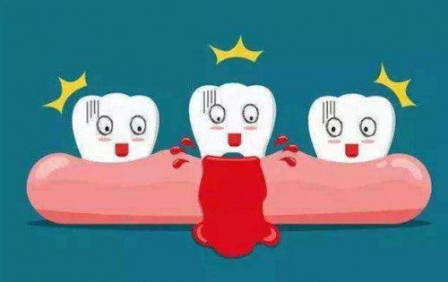 牙齿楔状缺损怎么补牙，补完还能用多久