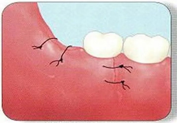 洛阳九龙口腔医院：疫情居家期间，牙科急诊该如何应对？