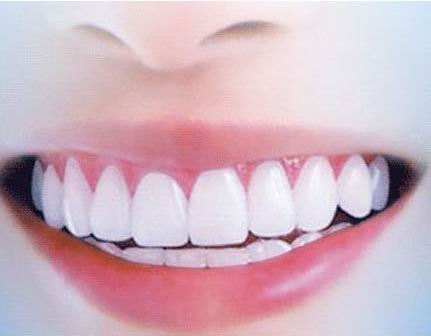 洛阳九龙口腔临床医生教你如何自检牙齿
