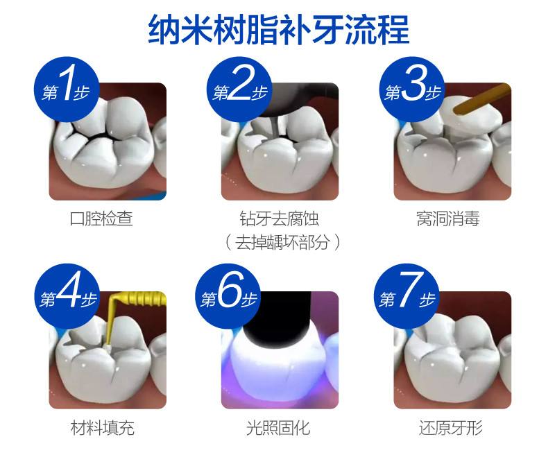 纳米树脂补牙要比一般的树脂好吗?多少钱?
