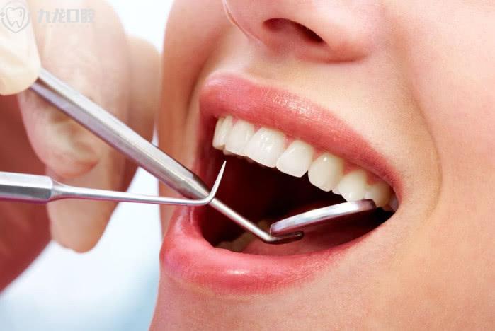 牙石清除的重要性