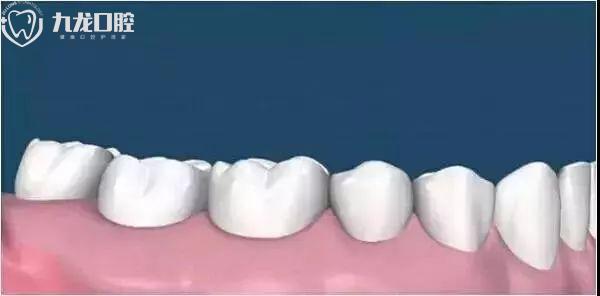 洛阳九龙口腔治疗牙周病需要多长时间