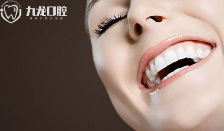 洛阳九龙口腔：瓷贴面能美白牙齿吗？