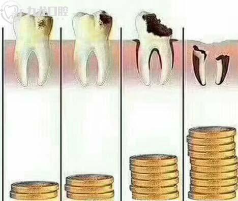 蛀牙龋坏严重和费用的关系