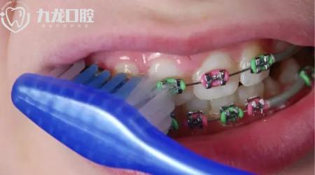 牙齿矫正时间能不能缩短些？