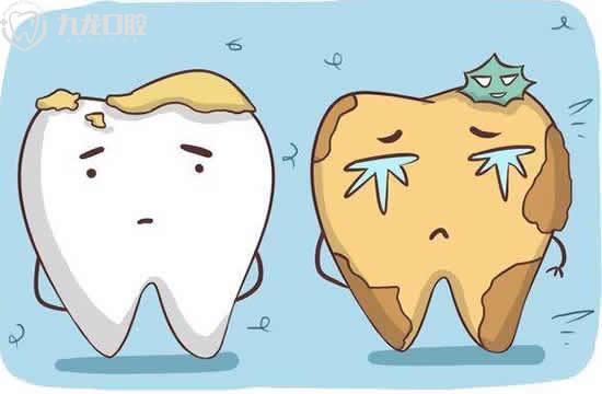 怎么防止牙齿龋坏