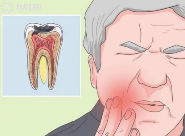 各类牙齿疼痛怎么办