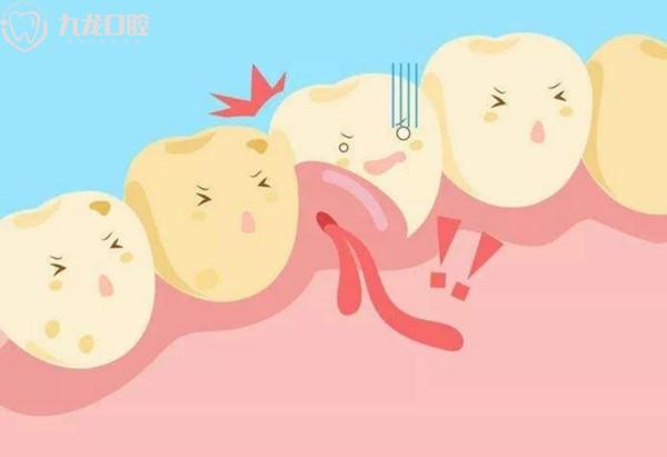 局部牙龈持续肿痛怎么办
